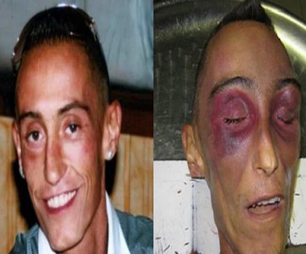 cucchi
